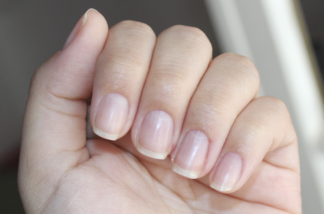 unhas